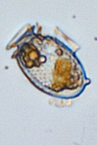 The new cytobot allows imaging of individual algal cells in real-time.