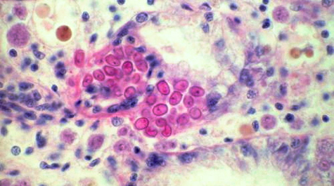 Haplosporidium nelsoni