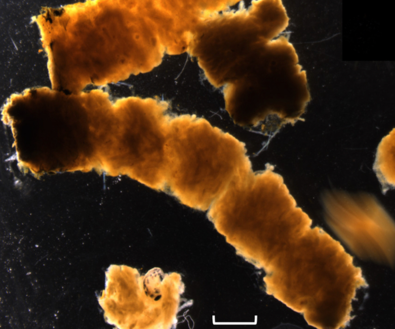 Salps produce fecal pellets that are larger and faster-sinking than those produced by most other species of zooplankton. The pellets therefore carry most of their carbon to the deep sea before it is eaten and recycled by other marine organisms. Scale bar is 2 millimeters. © K. Stamieszkin /Bigelow Laboratory.